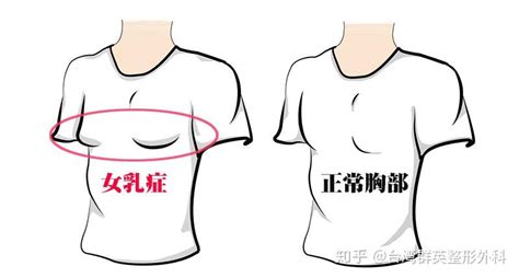 女人的乳頭